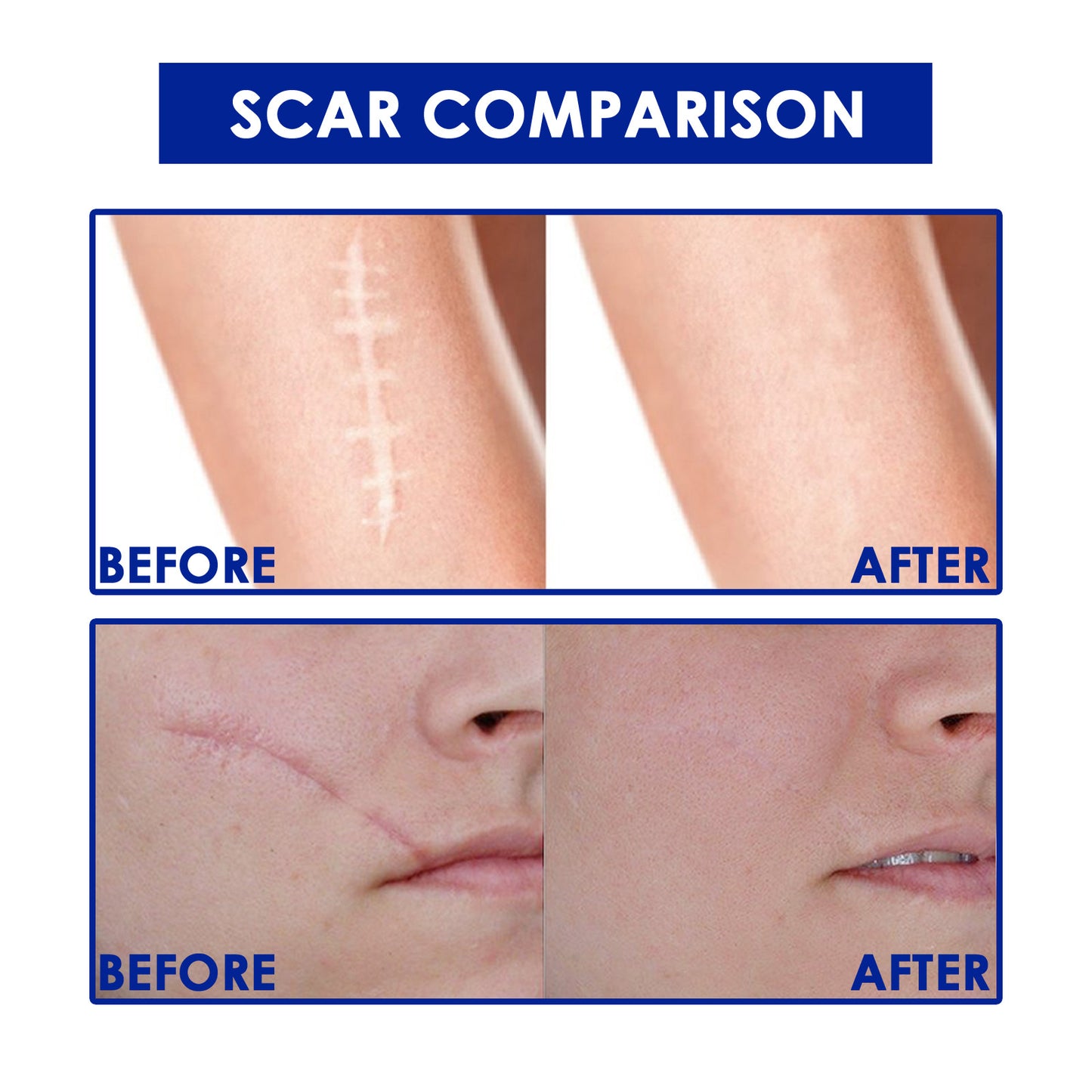 Scar repairing gel