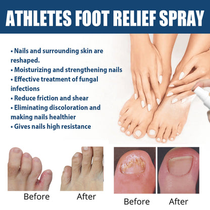 Foot spray relieves sweaty, itchy and peeling feet