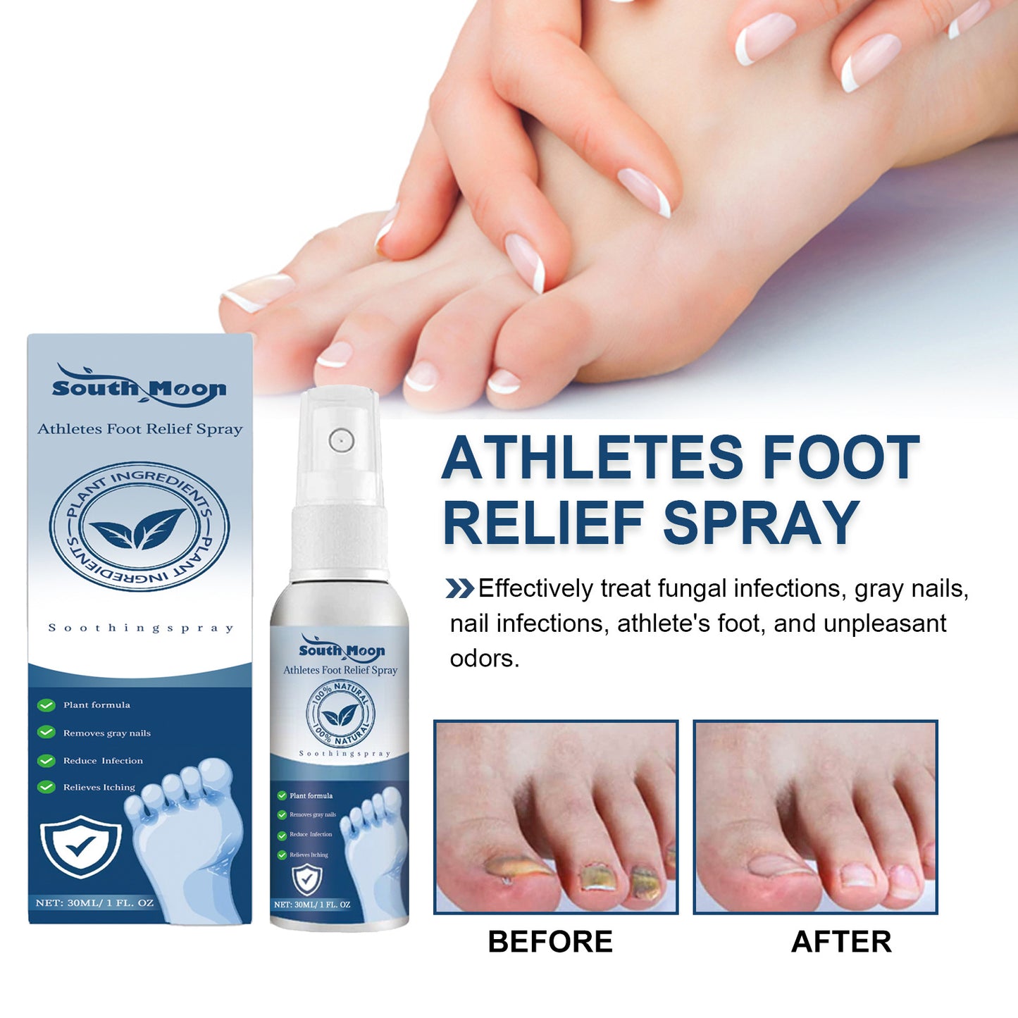 Foot spray relieves sweaty, itchy and peeling feet