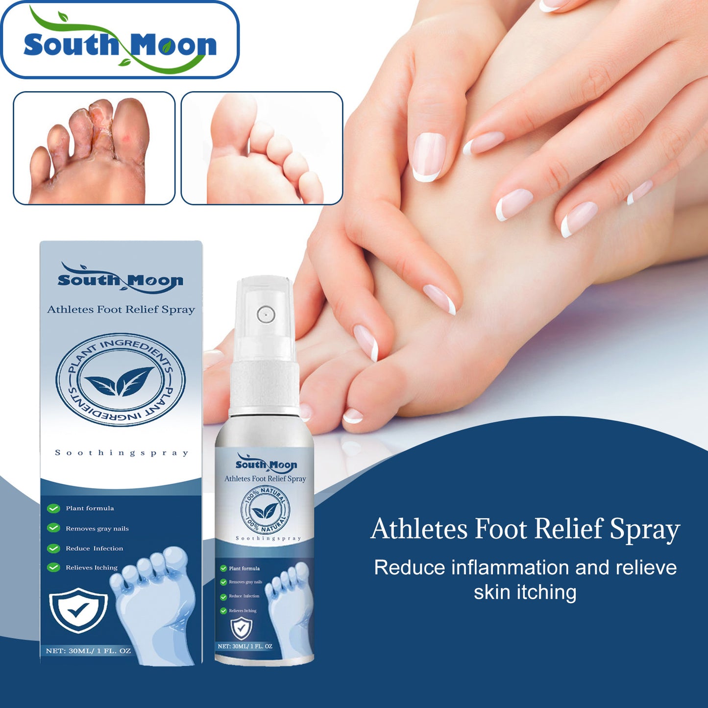 Foot spray relieves sweaty, itchy and peeling feet