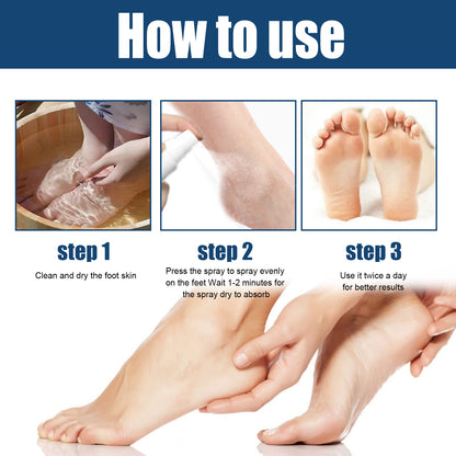 Foot spray relieves sweaty, itchy and peeling feet